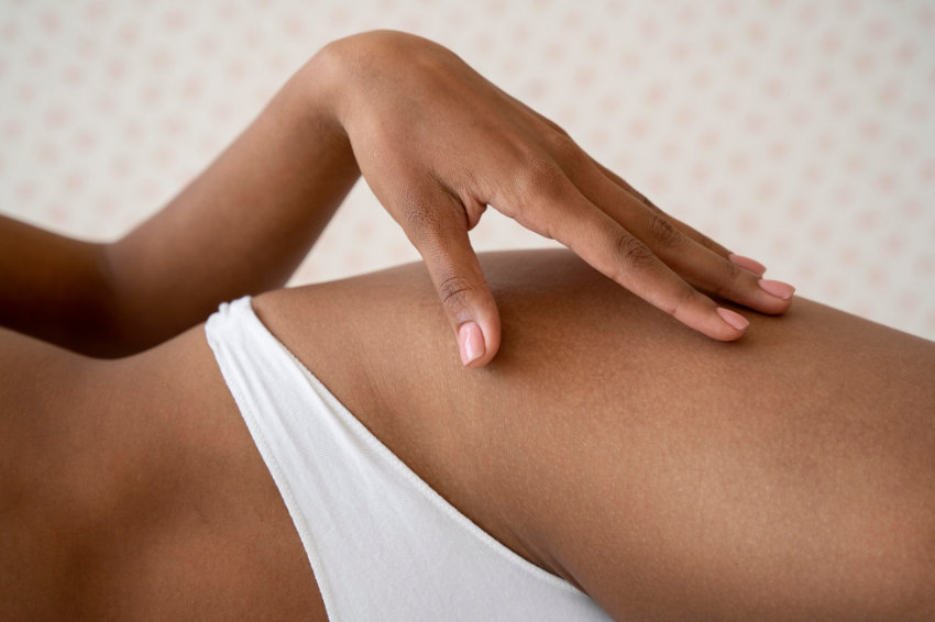 Brazilska depilacija