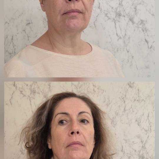 Angels Beauty - Banja Luka usluga