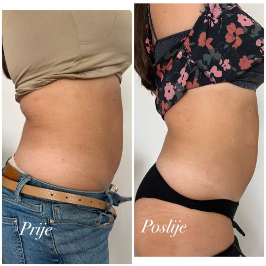 Beauty centar Eden usluga