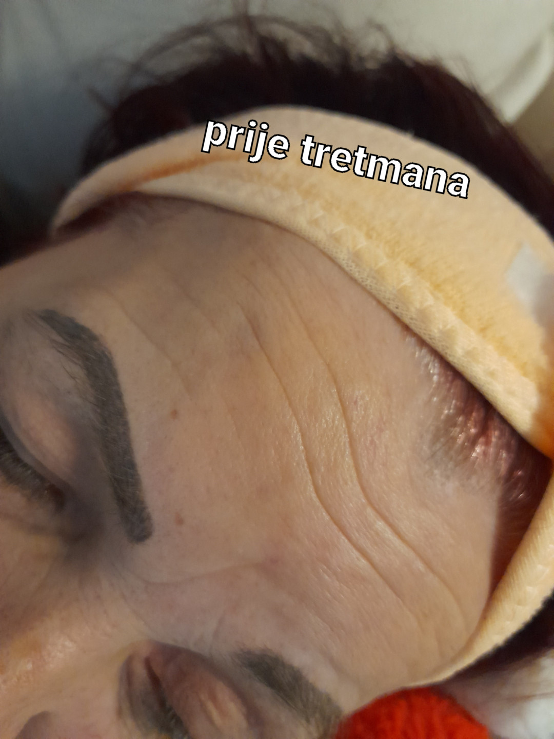 Tretman zlatnim + srebrnim nitima lice - Poezija ljepote, Sarajevo Ojačavanje noktiju Nokti Ojačavanje noktiju, Sarajevo, Novo Sarajevo - Novi Grad