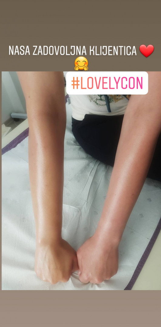 Relax Studio Hodžić #sarajevo Depilacija voskom Depilacija cijelih ruku Lycon voskom - za dame i muškarce