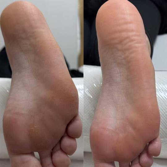 Artistic Beauty #sarajevo Estetski pedikir Ruski pedikir Ruski pedikir je savršen način za njegu v