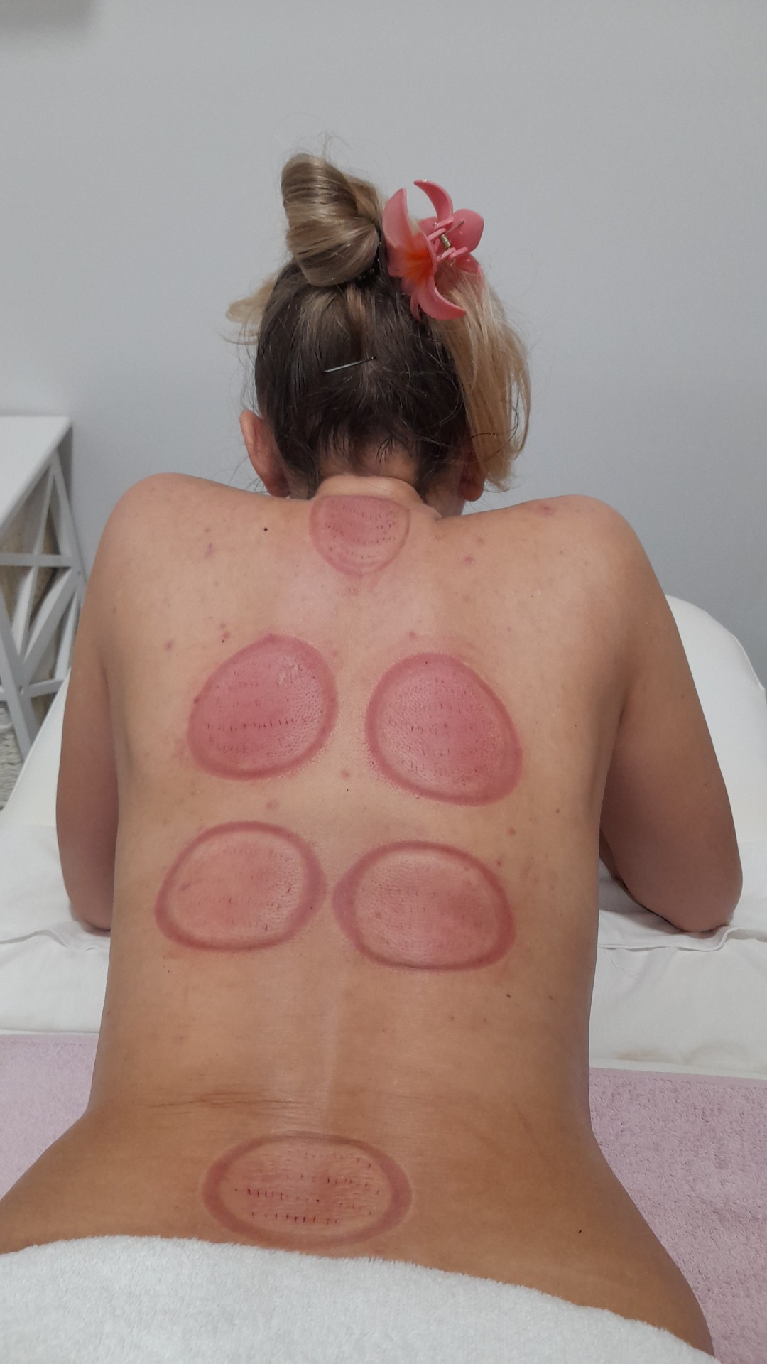 Salus #sarajevo Opšta masaža Hidžama + masaža