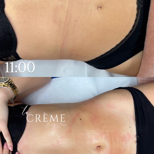 La Crème Beauty Studio usluga