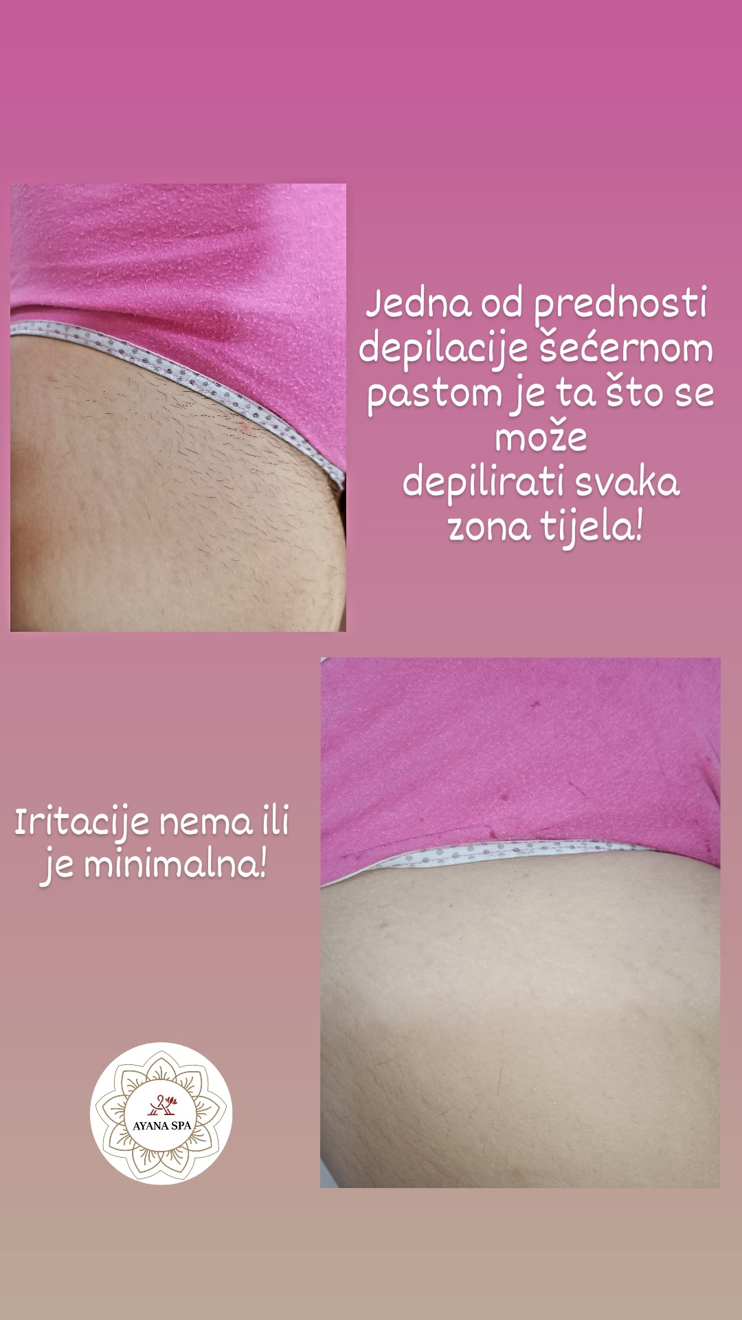 Ayana Spa #sarajevo Brazilska depilacija Depilacija basic bikini zone šećernom pastom - za dame