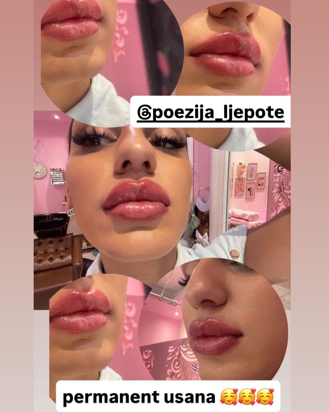 Poezija ljepote #sarajevo Trajna šminka Trajna šminka - usne