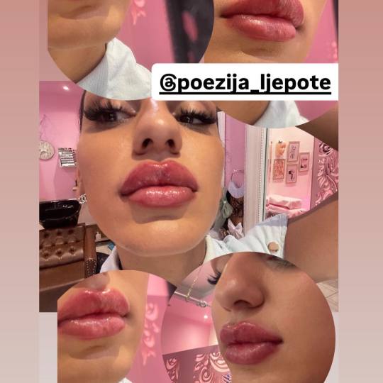 Poezija ljepote #sarajevo Trajna šminka Trajna šminka - usne