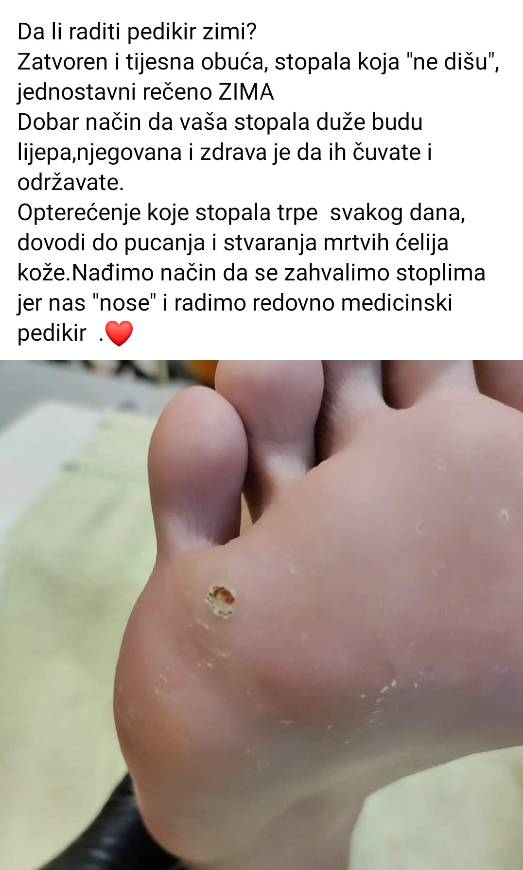 Kuća ljepote Djenna #sarajevo Medicinski pedikir Medicinski pedikir