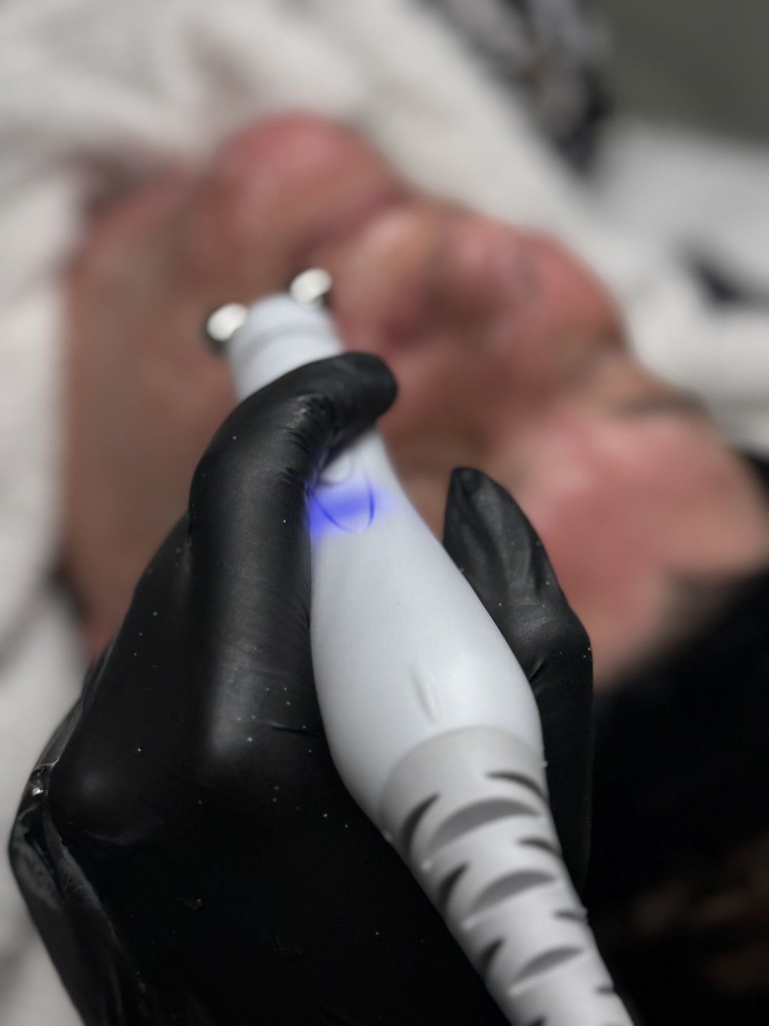 Magnifiqe beauty house #sarajevo Tretman lica Hydra facial tretman lica - 6 u 1