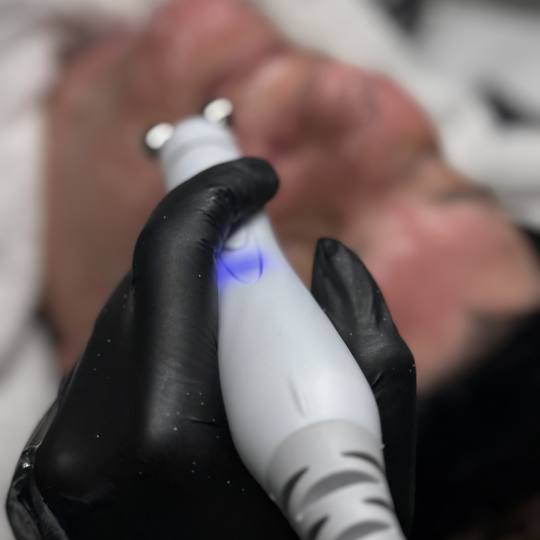 Magnifiqe beauty house #sarajevo Tretman lica Hydra facial tretman lica - 6 u 1