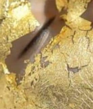 Sandra #visoko Tretman lica Biorevitalizacija lica