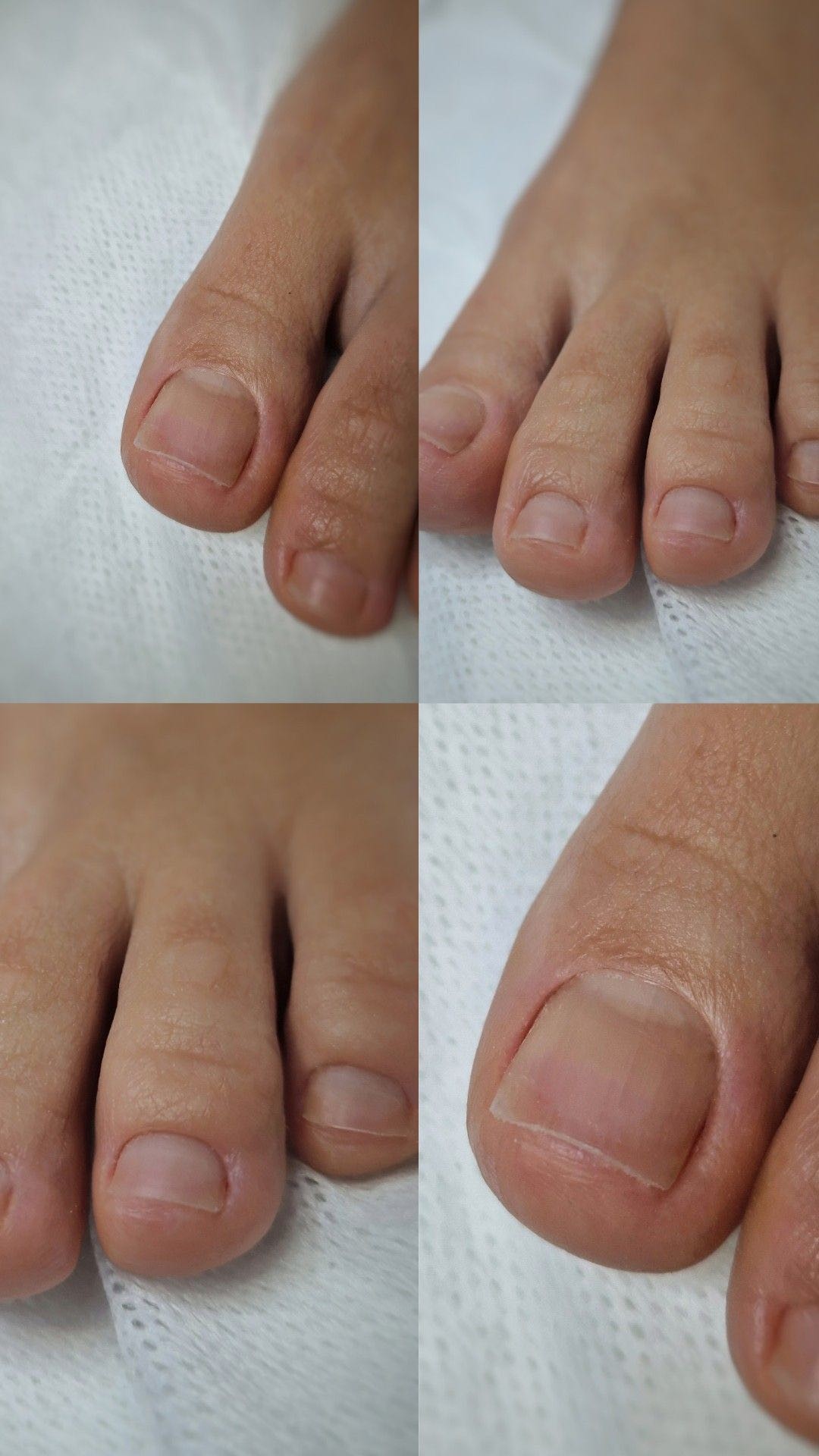 Poezija ljepote #sarajevo Estetski pedikir Ruska pedikura - bez laka