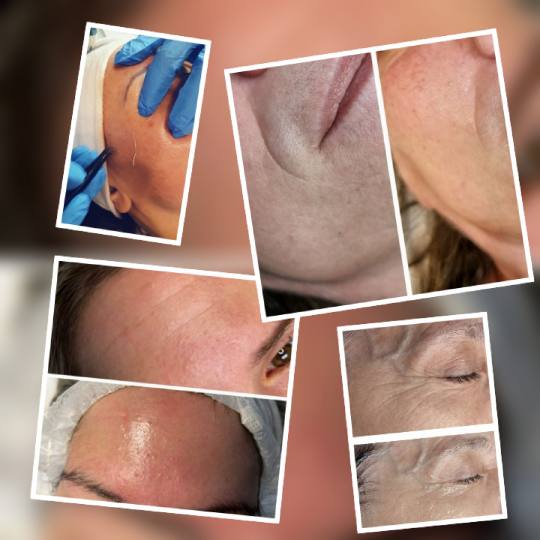 Poezija ljepote #sarajevo Ojačavanje noktiju Tretman zlatnim + srebrnim nitima lice