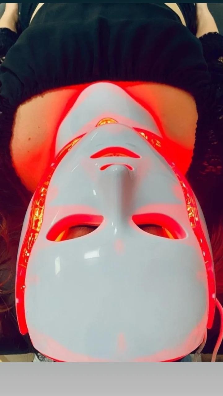 Poezija ljepote #sarajevo Tretman lica Dermapen tretman lica