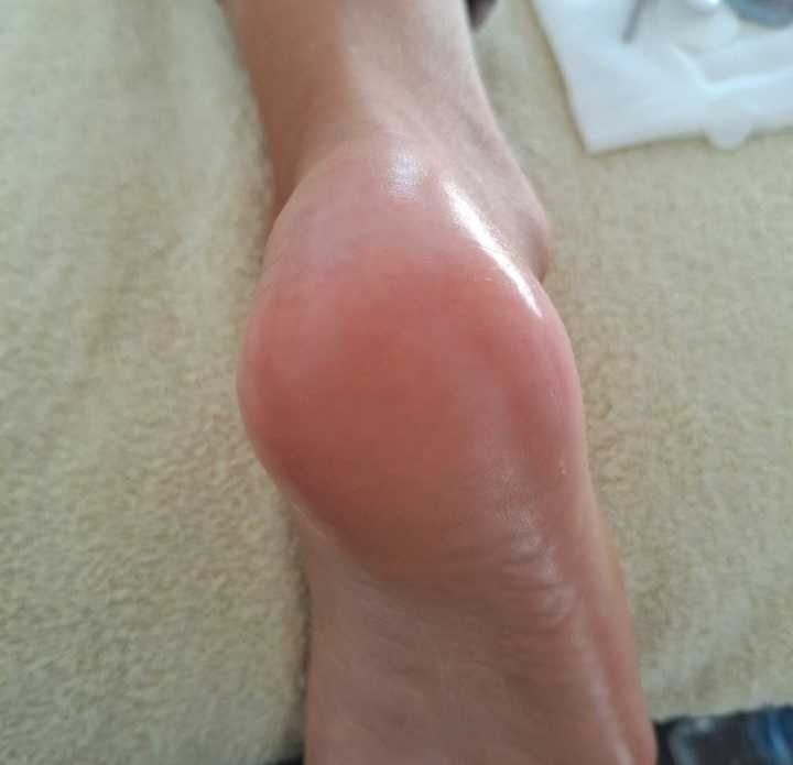 Poezija ljepote #sarajevo Estetski pedikir Klasična pedikura + trajni lak