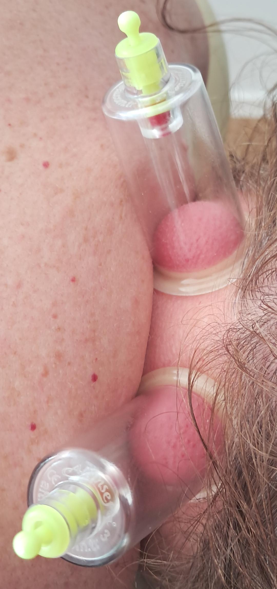 Sakina #sarajevo Hidžama Lokalizirana hidžama - 1 do 3 tačke