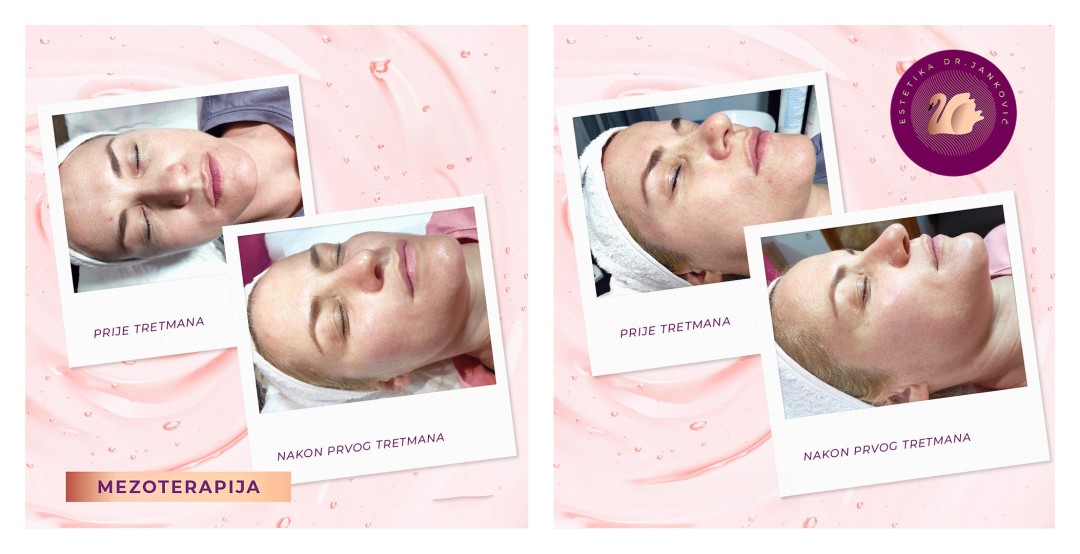 Estetika Janković #banjaluka