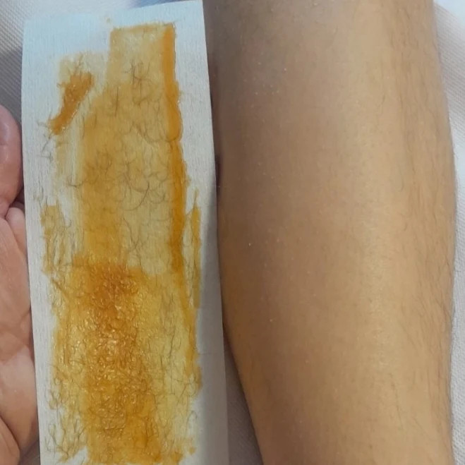 Poezija ljepote #sarajevo Depilacija nogu Depilacija cijelih nogu hladnim voskom - za dame