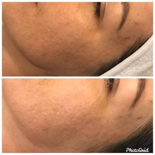 Vedrana #sarajevo Tretman lica Prije više od 60 godina, Christine Schrammek postavila je temelje or