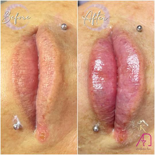 AEsthetic Bar Academy #sarajevo Tretman lica