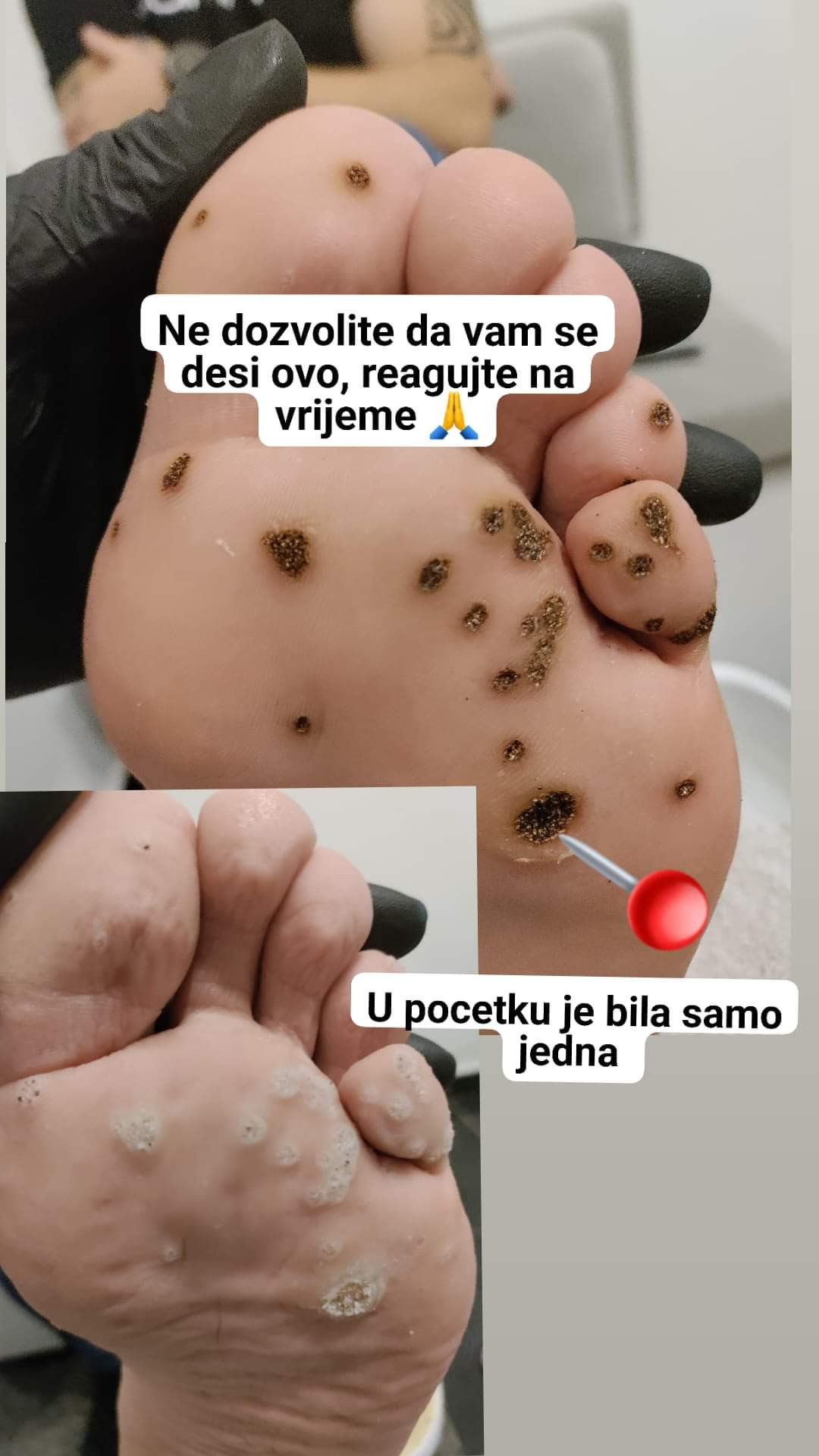 Kuća ljepote Djenna #sarajevo Medicinski pedikir Medicinski pedikir