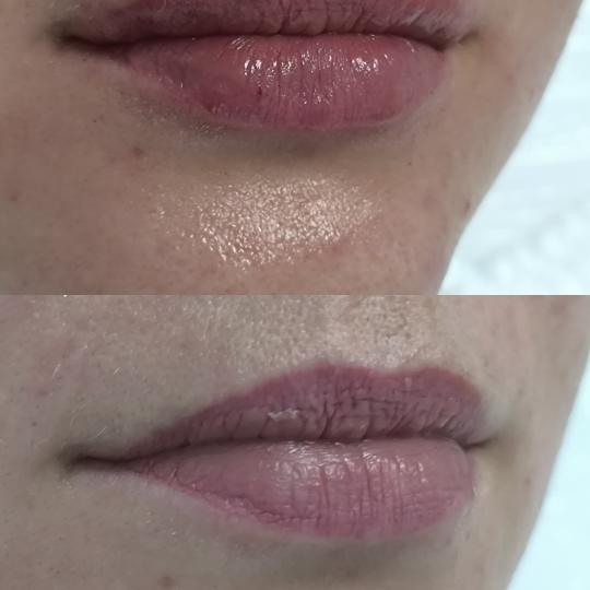 Estetika Janković usluga