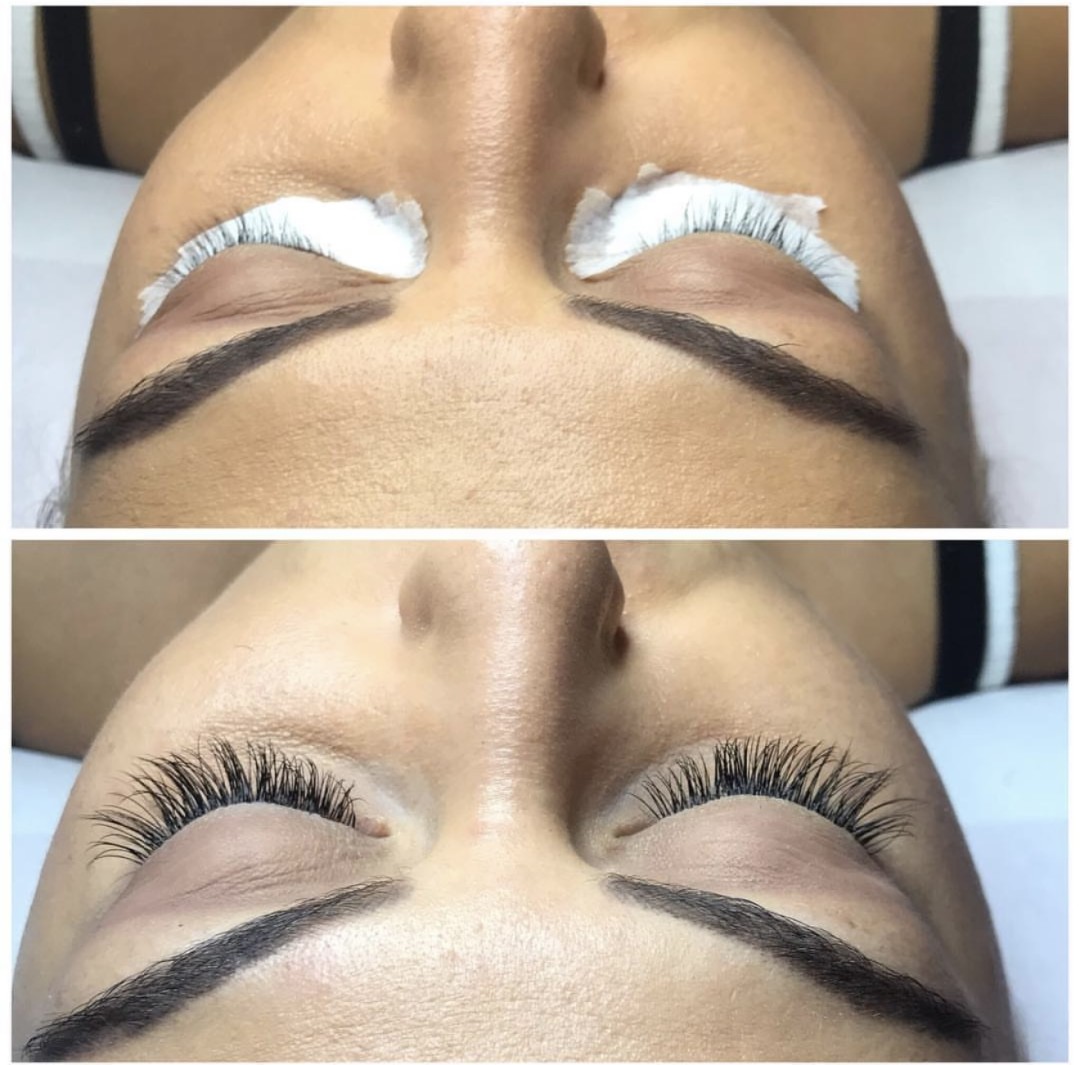 Damen #sarajevo Depilacija voskom Enzimski piling + ultrazvučno ćišćenje lica + vitamin C / kologen / hijaluron