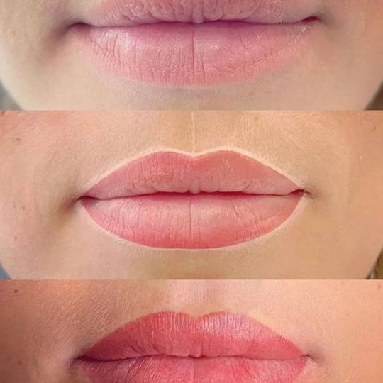 Poezija ljepote #sarajevo Trajna šminka Trajna šminka - usne