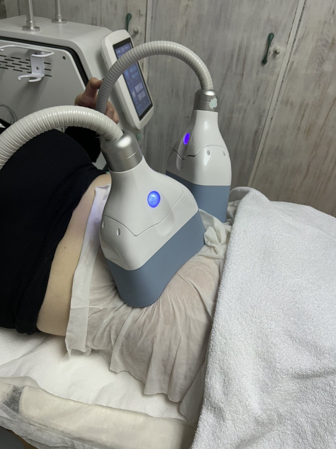 Rebloom #sarajevo Tretmani za mršavljenje Rebloom kriolipoliza - jedna regija sa dvije sonde