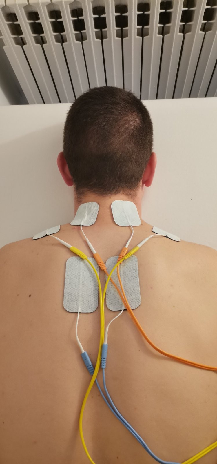 Nervus #banjaluka Terapeutski tretmani Elektroterapija