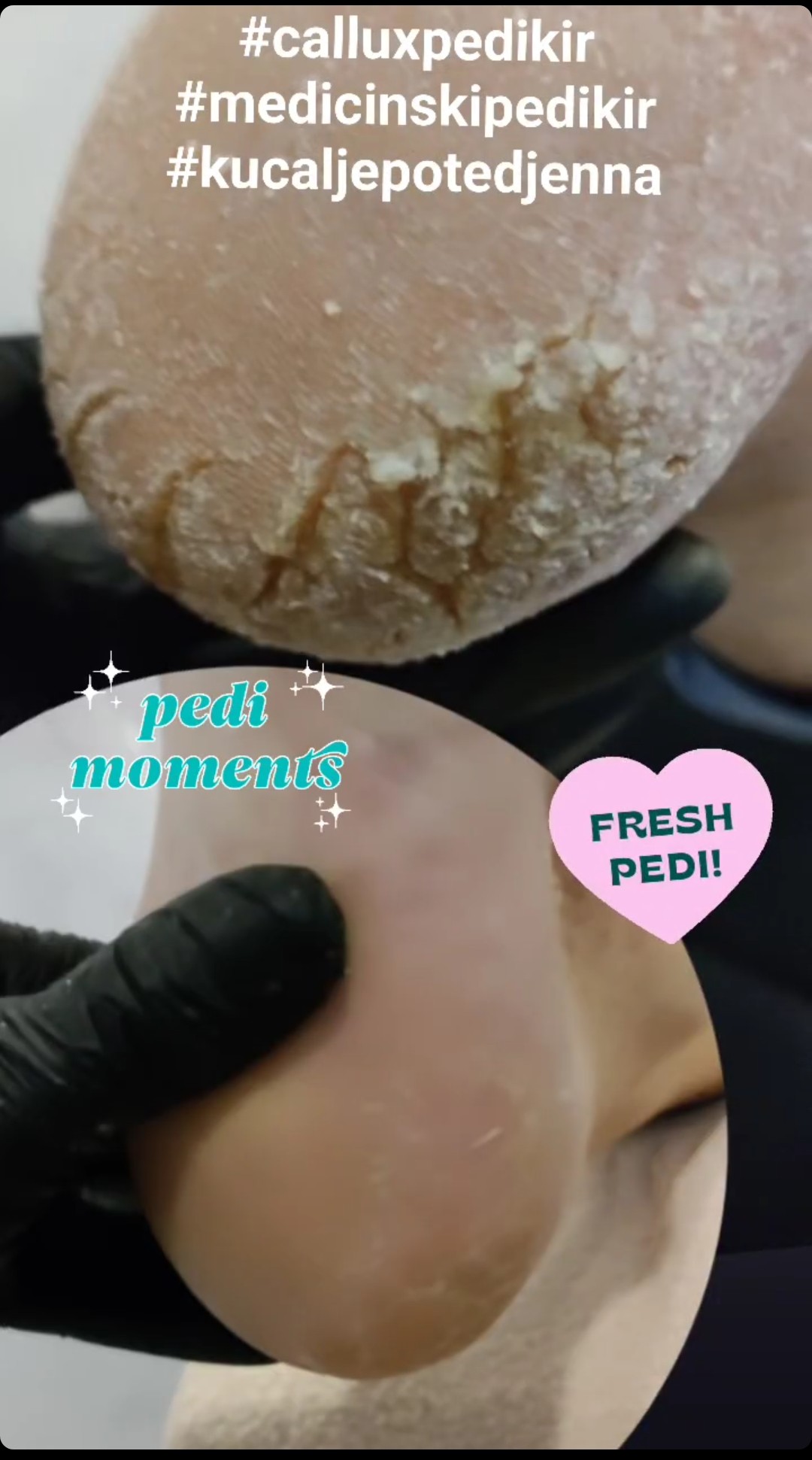 Kuća ljepote Djenna #sarajevo Medicinski pedikir Medicinski pedikir
