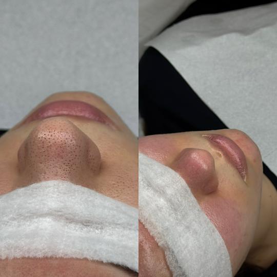 Hanas Skin Centar usluga