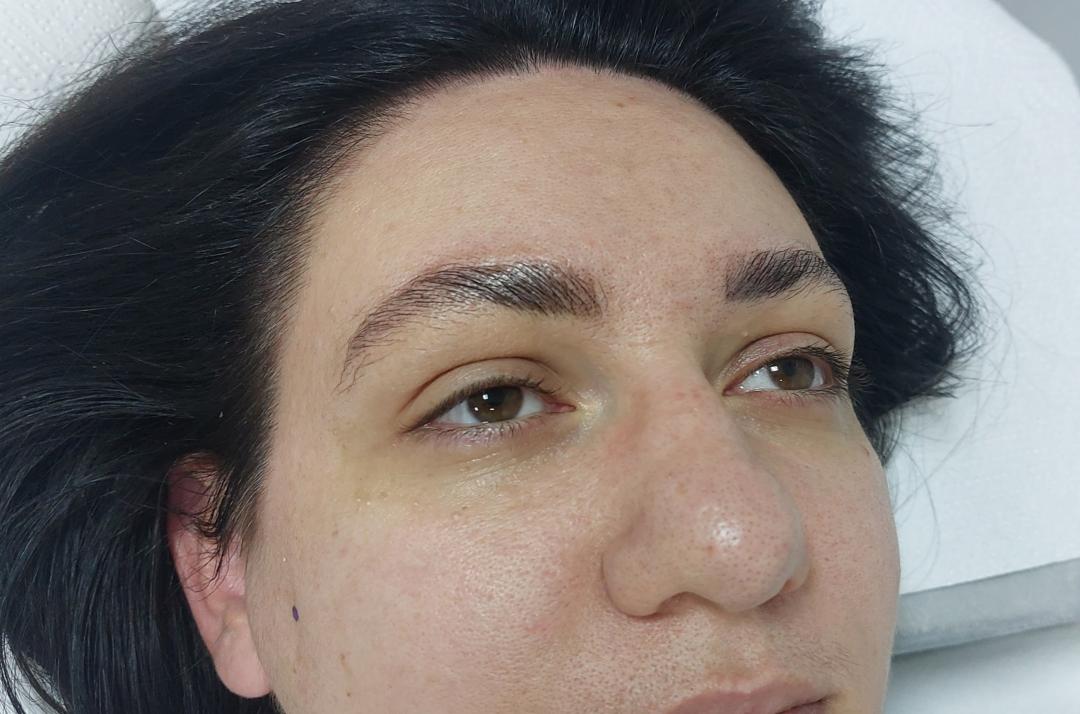Brow lift - Tajne jednog beauty salona, Sarajevo Obrve Lice Obrve, Sarajevo, Ilidža