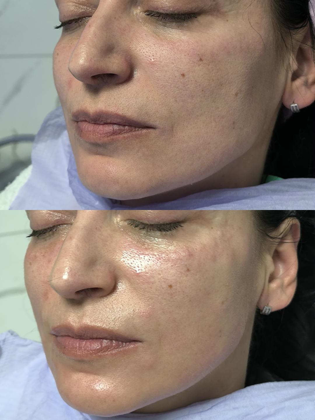 Španski sjaj - Estetika Janković, Banja Luka Tretman lica Lice Tretman lica, Banja Luka, Centar