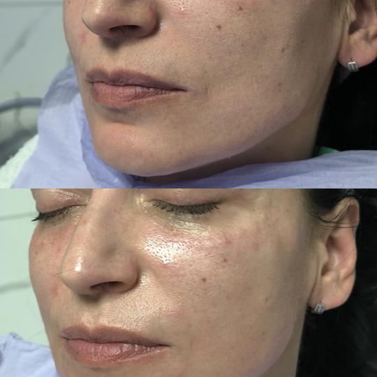 Estetika Janković usluga