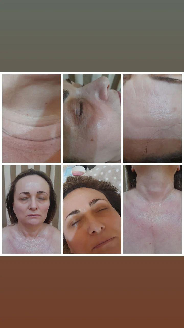 Tretman zlatnim + srebrnim nitima lice - Poezija ljepote, Sarajevo Ojačavanje noktiju Nokti Ojačavanje noktiju, Sarajevo, Novo Sarajevo - Novi Grad