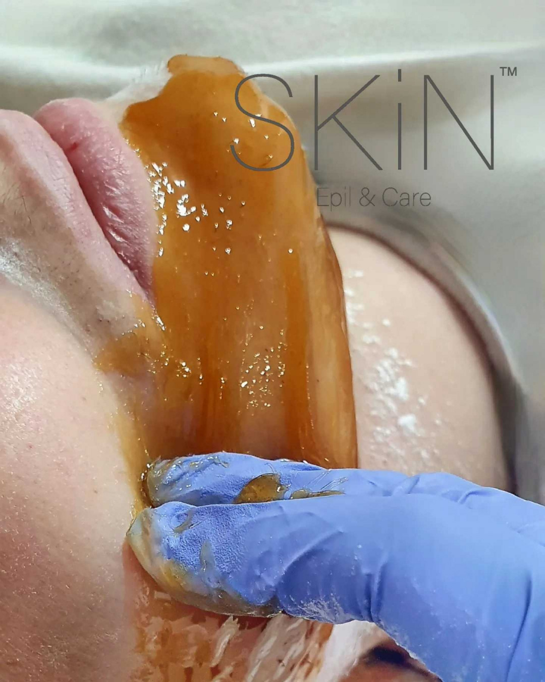 Skin Epil & Care #sarajevo Depilacija šećernom pastom Depilacija lica šećernom pastom - za dame