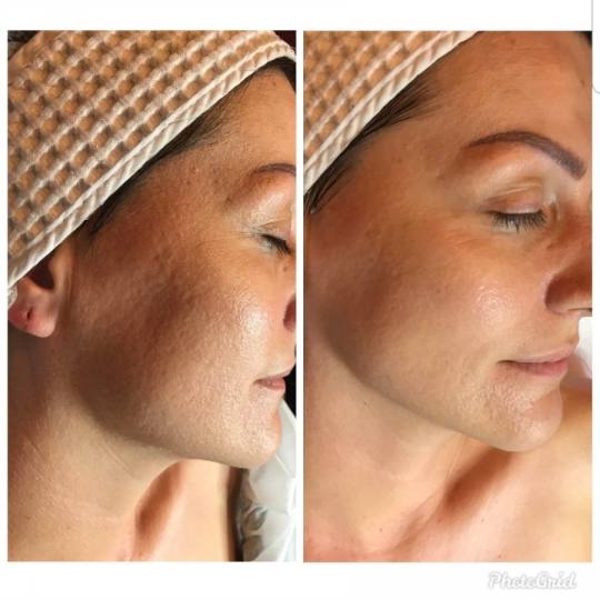 Vedrana #sarajevo Tretman lica Prije više od 60 godina, Christine Schrammek postavila je temelje or