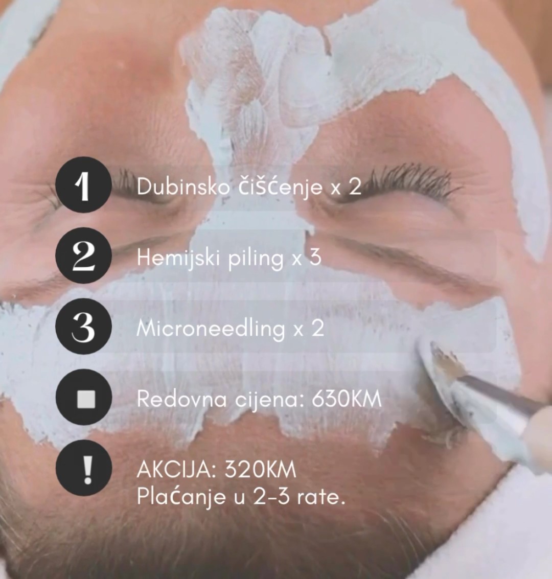 Fabrika ljepote #sarajevo Tretmani tijela Paket tretmana za kožu u 30- im i 40-im