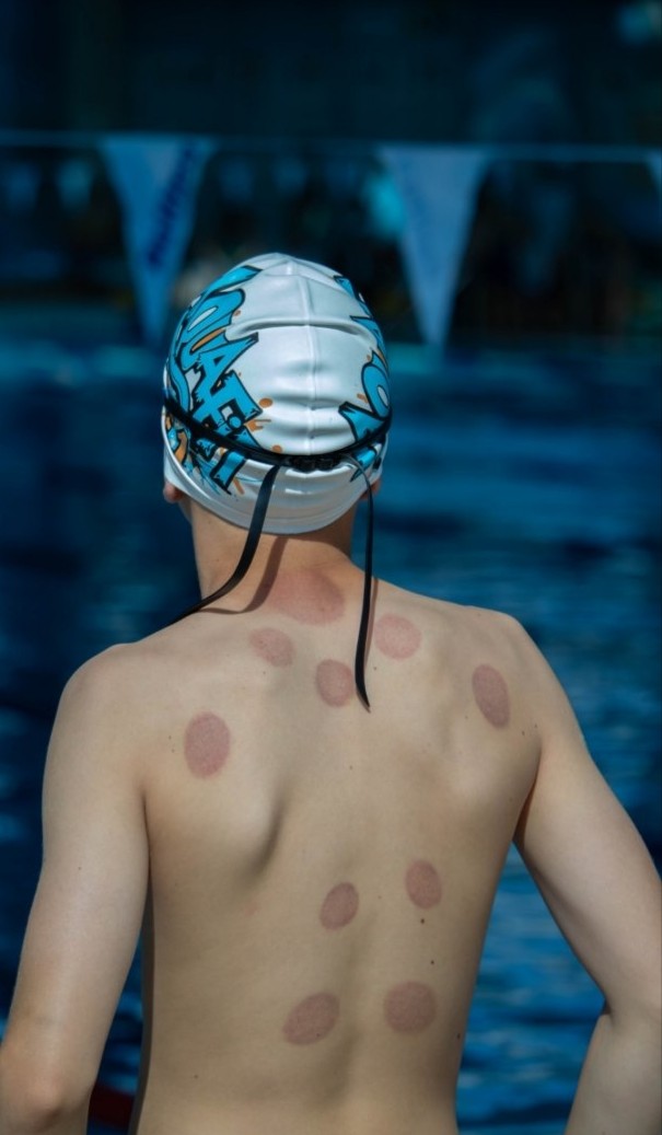 Hidžama - FizioRelax + HaloTherapy, Sarajevo Tretmani tijela Tijelo Tretmani tijela, Sarajevo, Centar - Stari Grad