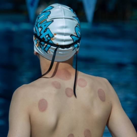 FizioRelax + HaloTherapy #sarajevo Tretmani tijela Hidžama Tretmani tijela