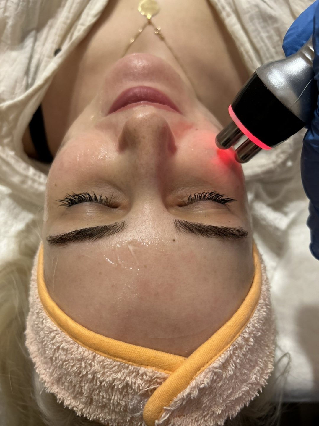 Health Care Koncept #sarajevo Tretman lica Radiofrekvencija lica + masaža lica