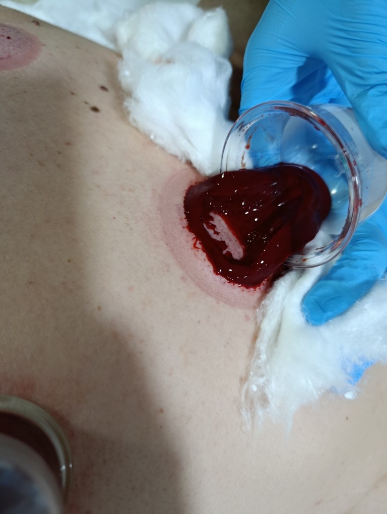 Soovica by Lida #tuzla