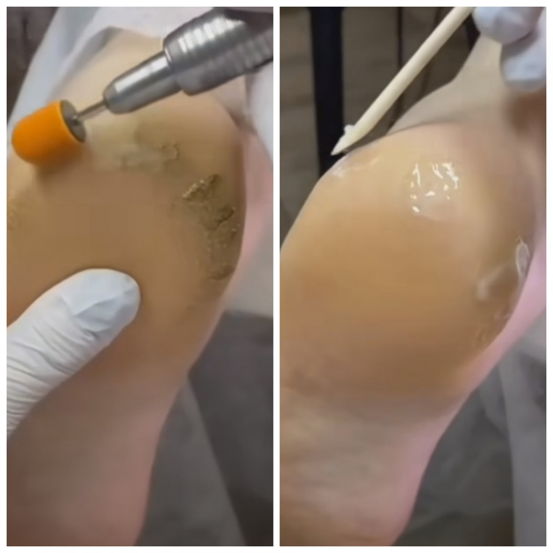 Poezija ljepote #sarajevo Estetski pedikir Klasična pedikura + trajni lak