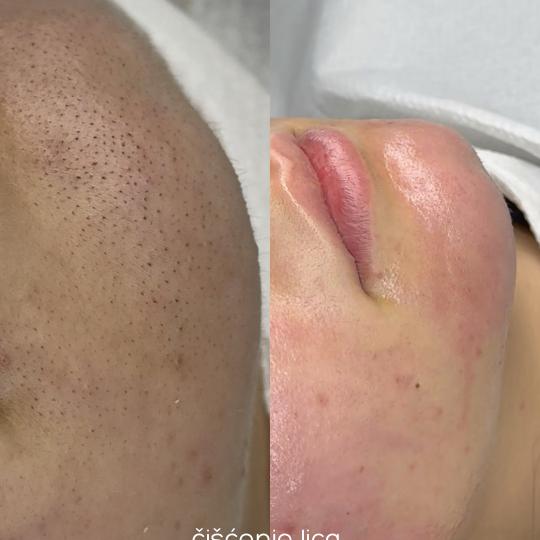 Hanas Skin Centar usluga