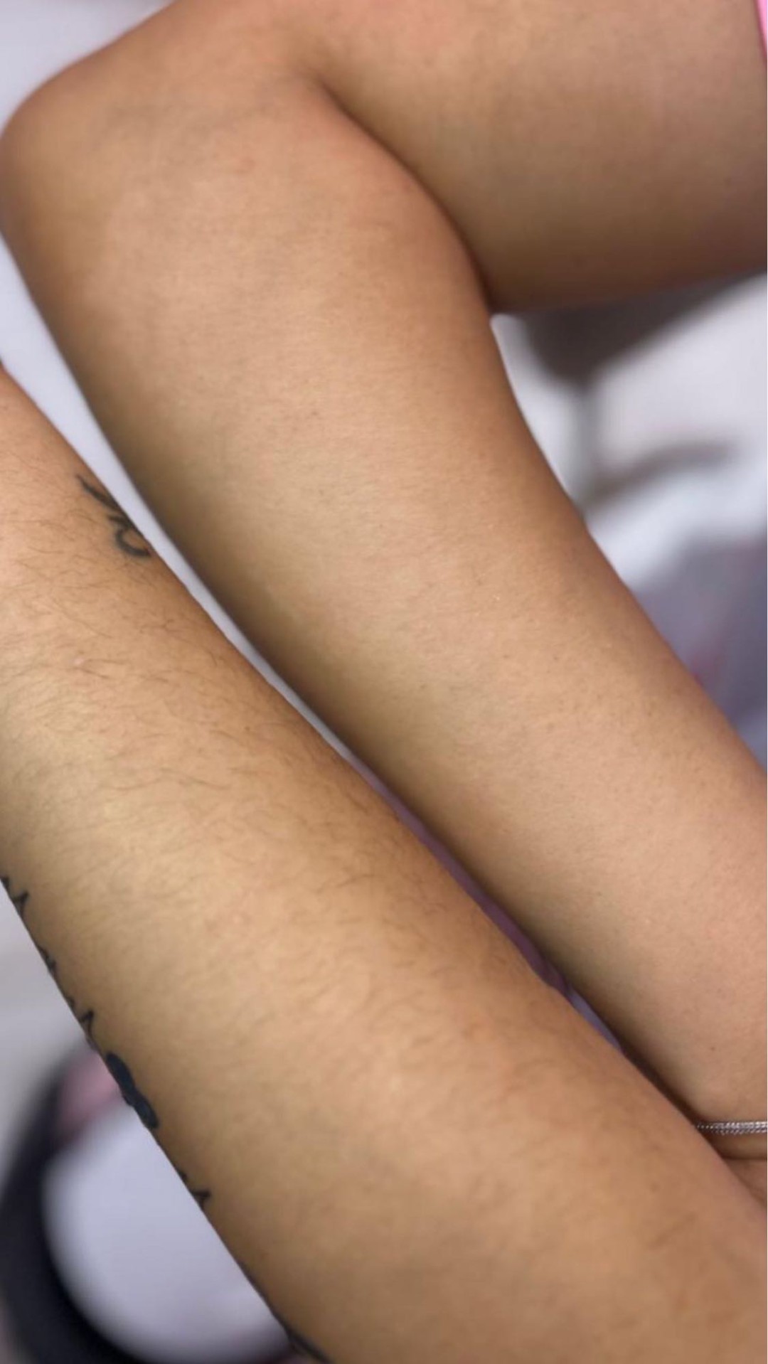 Poezija ljepote #sarajevo Depilacija voskom Depilacija cijelih ruku hladnim voskom - za dame