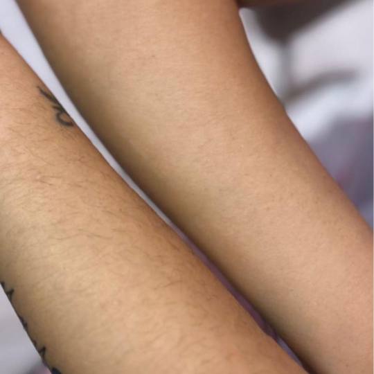 Poezija ljepote #sarajevo Depilacija voskom Depilacija cijelih ruku hladnim voskom - za dame