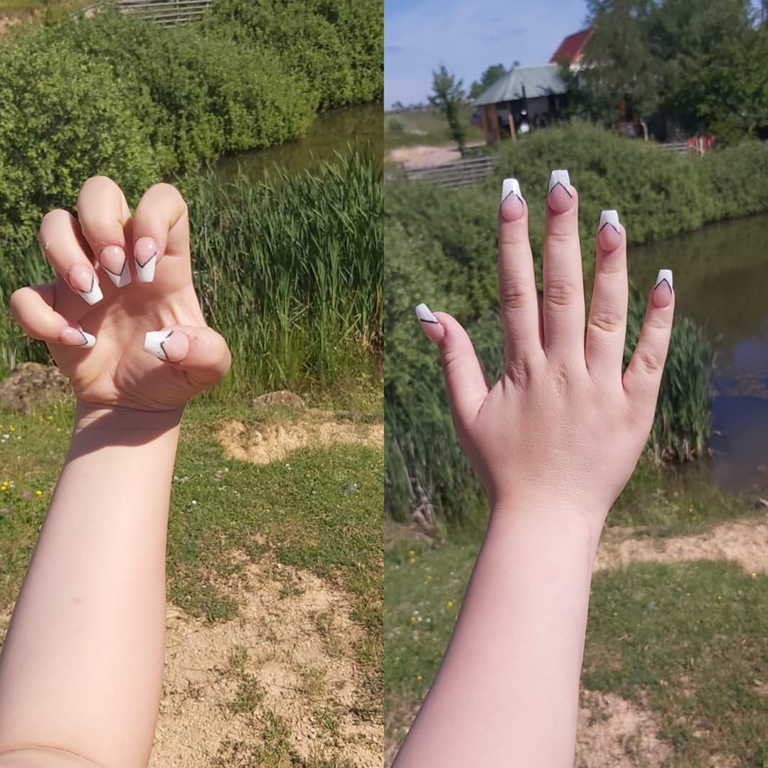 Shine - deaktivirano #sarajevo Izlivanje noktiju