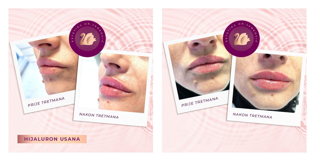 Estetika Janković #banjaluka