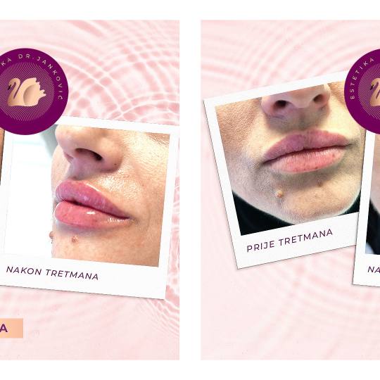 Estetika Janković #banjaluka